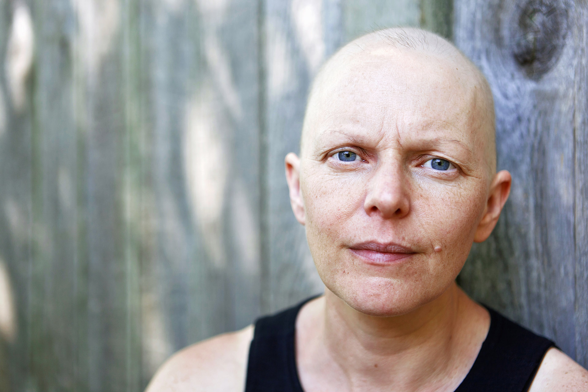 A woman being treated for breast cancer using chemotherapy poses for a portrait.